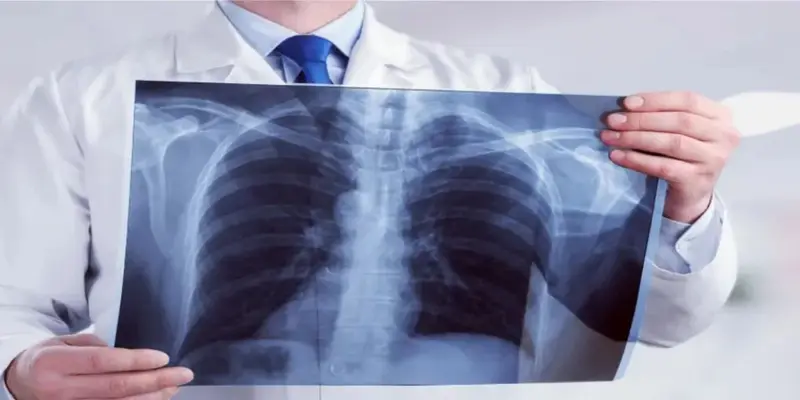 Így fejlesszük a tüdőkapacitást – asztma és COPD esetén különösen